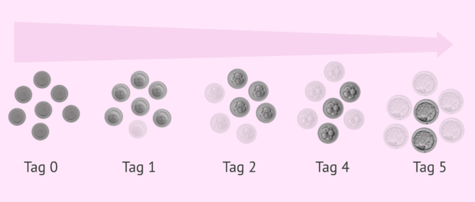 Imagen: Nur Embryonen guter Qualität erreichen das Blastozystenstadium