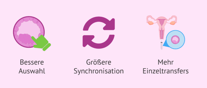 Imagen: Vorteile des Transfers von Blastozysten