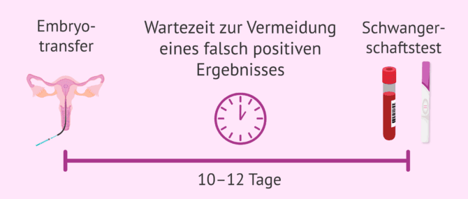 Imagen: Wann und wie man erfährt, ob nach dem Embryotransfer eine Schwangerschaft vorliegt
