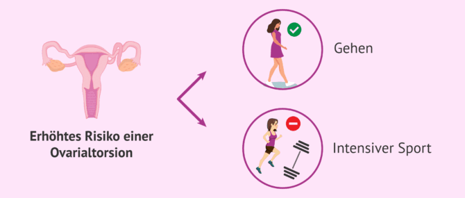 Imagen: Sport während der ovariellen Stimulation