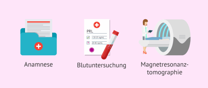 Imagen: Diagnostische Tests für Hyperprolaktinämie