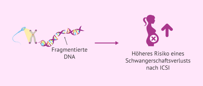 Imagen: DNA-Fragmentation der Spermien und Fehlgeburtsrisiko