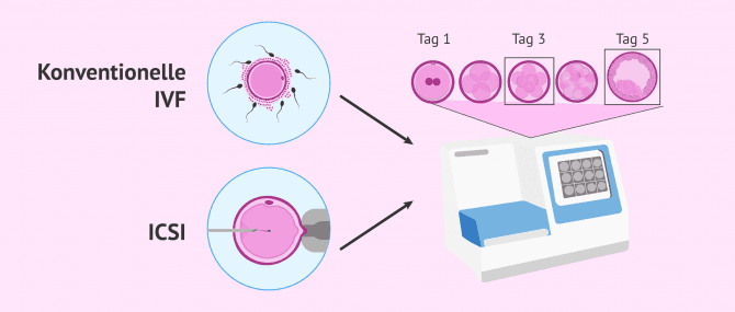Imagen: Was ist eine Embryokultur?