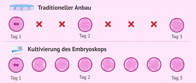Imagen: Embryoskopische Kultivierung vs. traditionelle Kultivierung