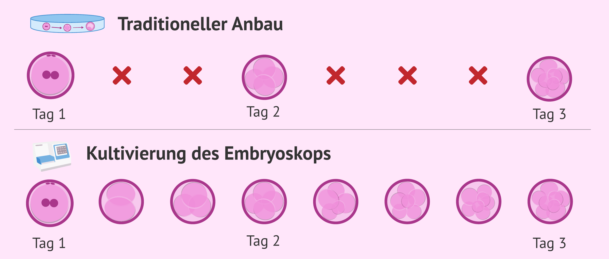 Was ist das Embryoskop und was sind seine Vorteile bei der IVF?