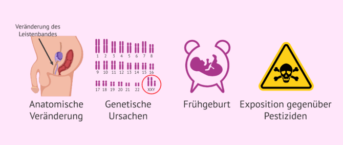 Imagen: Mögliche Ursachen für Kryptorchismus