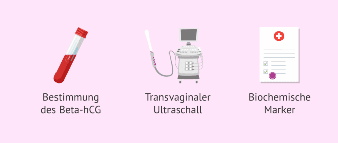 Imagen: Tests zur Erkennung einer extrauterinen Schwangerschaft
