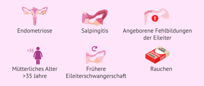 Imagen: Risikofaktoren für eine Schwangerschaft außerhalb der Gebärmutter