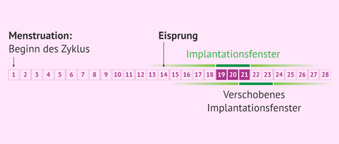 Imagen: Implantationsfenster und ERA-Test