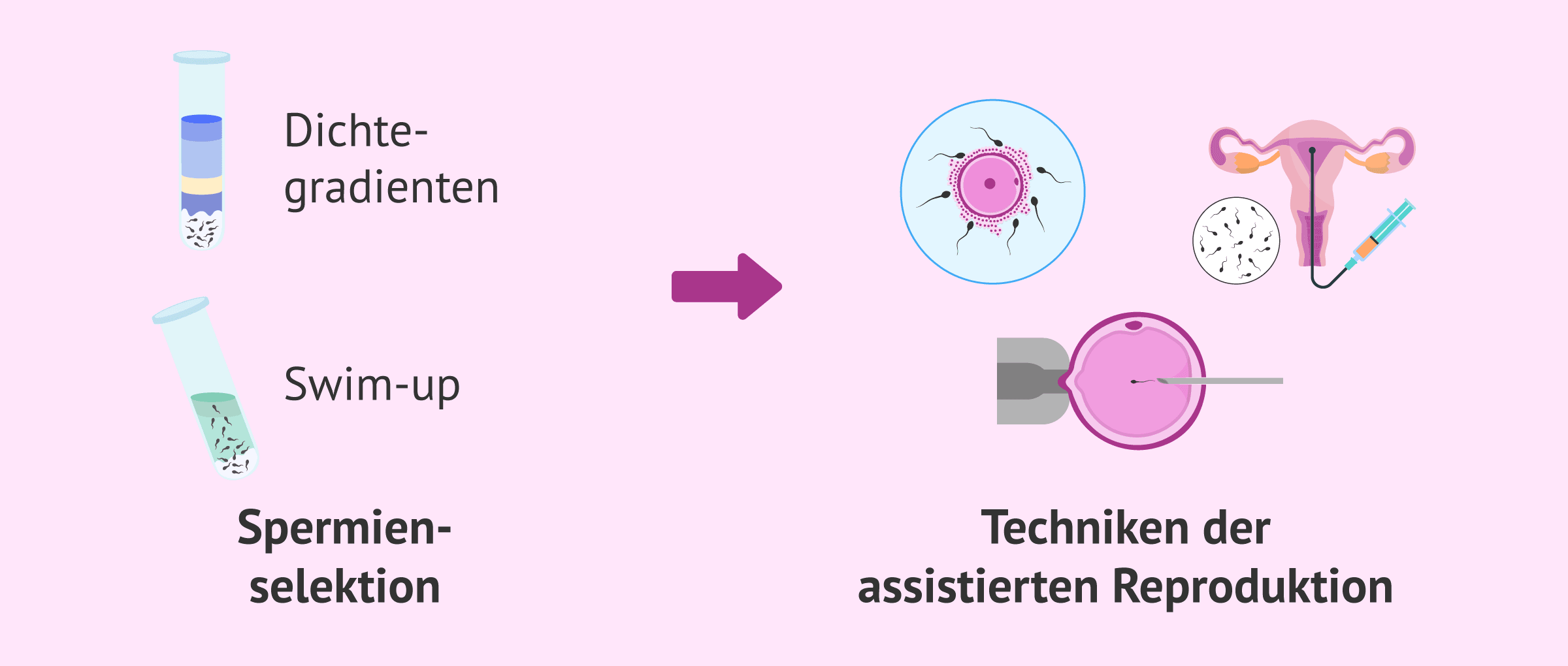 Imagen: Traditionelle Methoden der Spermienselektion