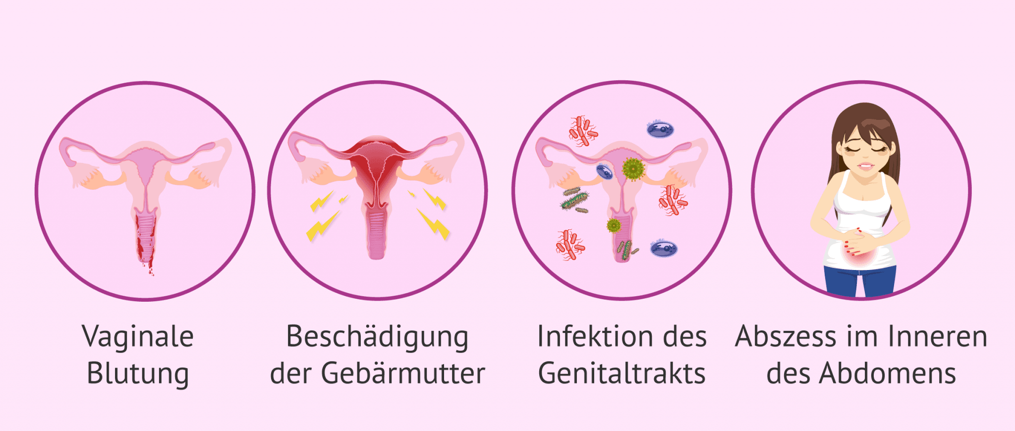 Wer Ist Durch Rauszieh Methode Schwanger Geworden Mögliche Auswirkungen und Risiken eines Schwangerschaftsabbruchs