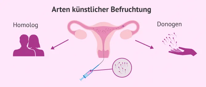 welcher künstliche weihnachtsbaum sieht echt aus Künstlicher Weihnachtsbaum Tannenbaum grün künstlich 180 cm täuschend  naturgetreuer Tannenbaum (PREMIUM) main image 1