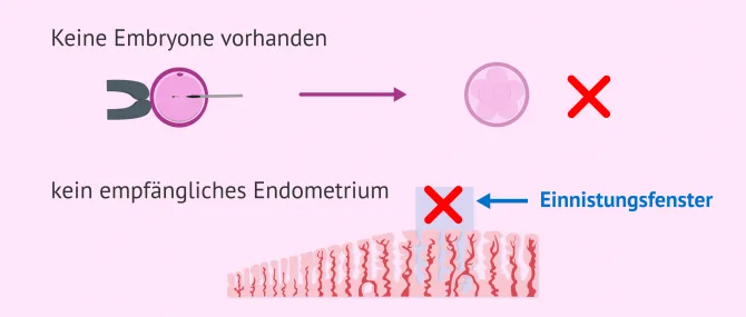 Warum werden manchmal IVF-Zyklen abgebrochen?