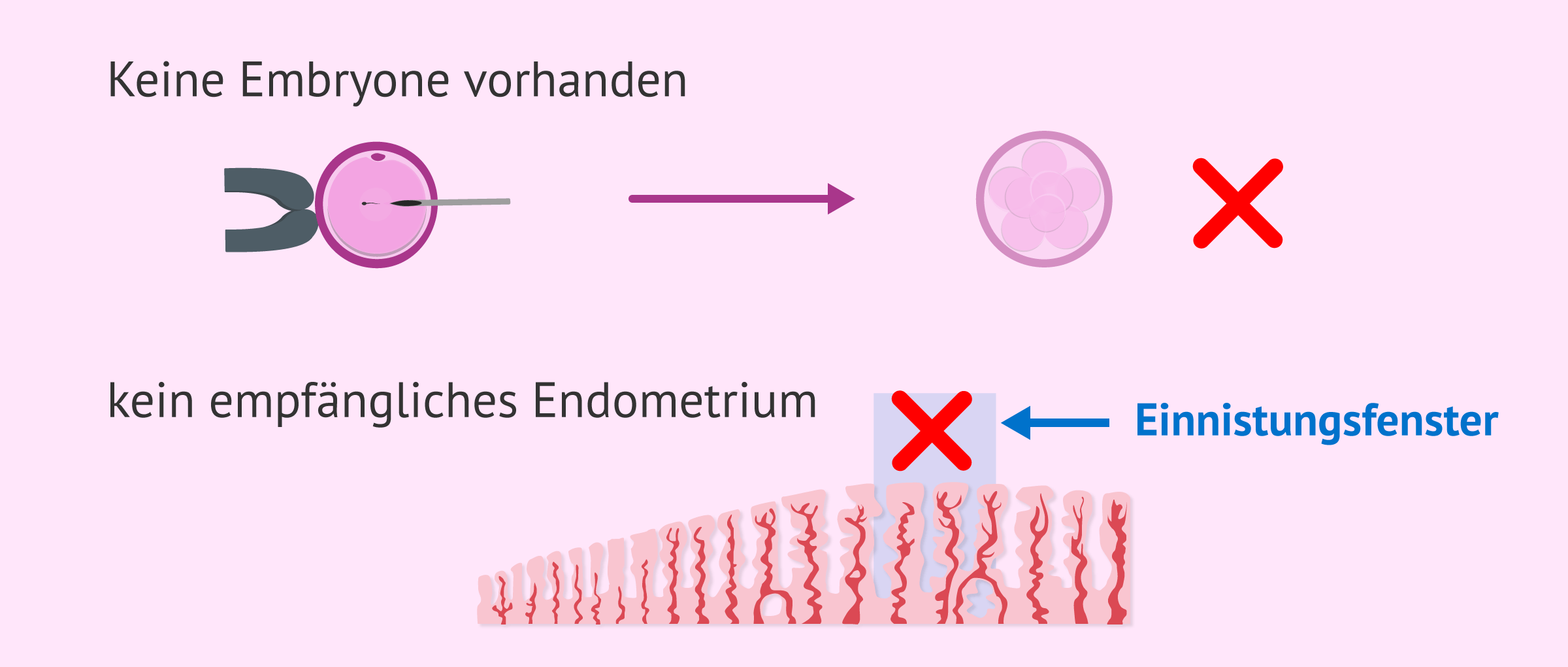 Embryotransfer abbrechen