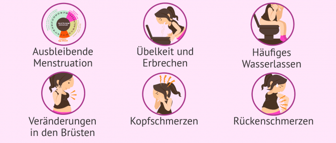 Imagen: Erste Schwangerschaftssymptome