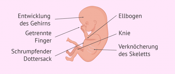 Imagen: Entwicklung des Fötus in der 10. Woche