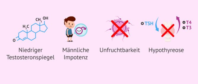 Imagen: Folgen hoher Prolaktinspiegel beim Mann