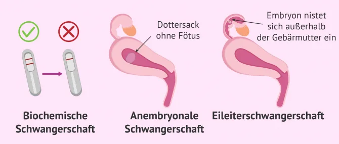 Die Schwangerschaft: Symptome und Entwicklung des Ftus