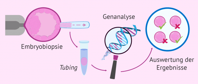 Imagen: Was macht man in einer PID?
