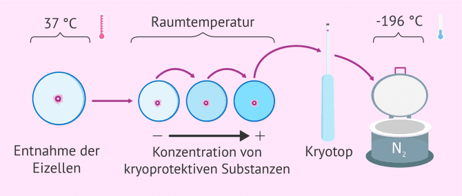 Imagen: Vorgang bei Eizellenvitrifizierung