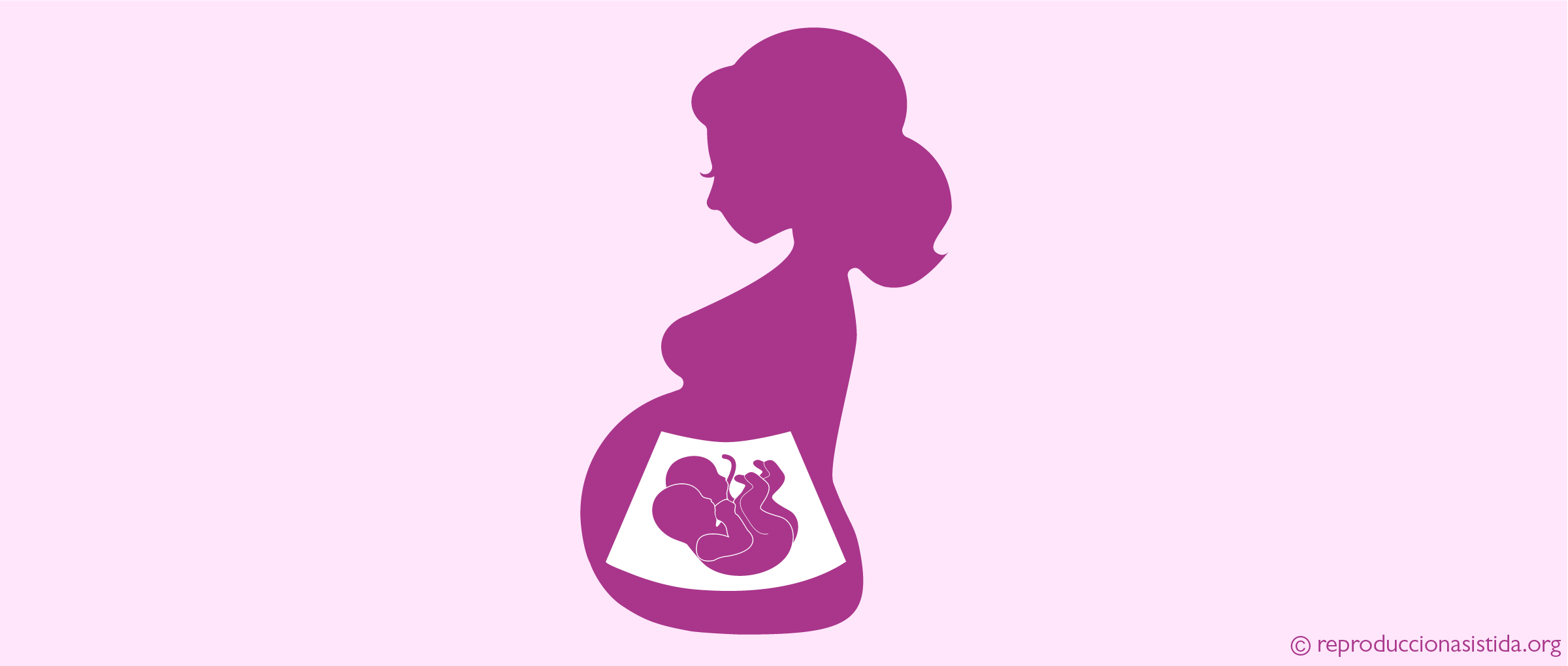 Höheres Risiko einer Mehrlingsschwangerschaft bei der IUI