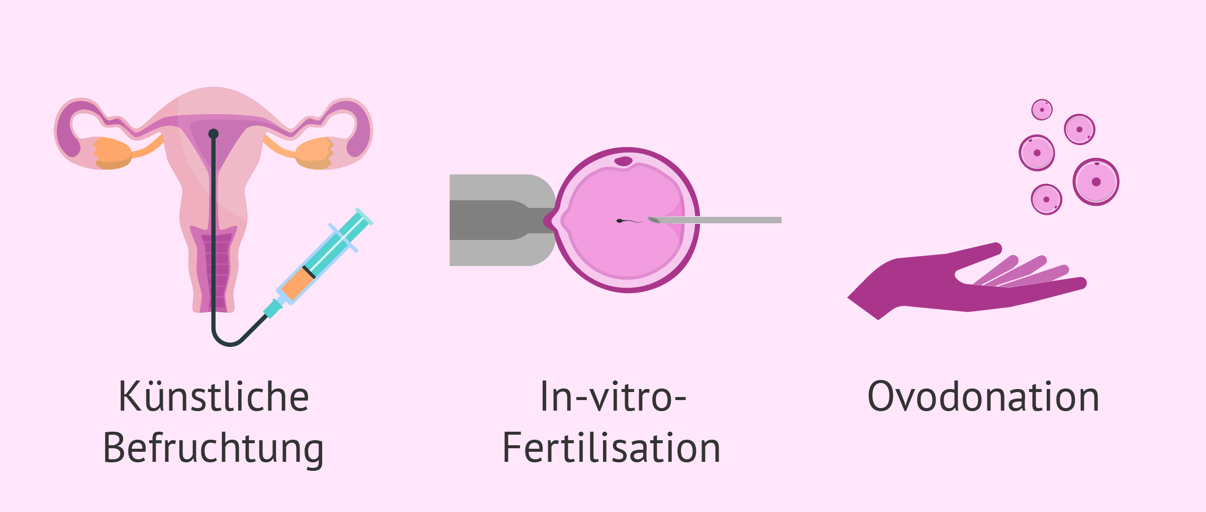 Assistierte Reproduktion für Endometriose-Patientinnen