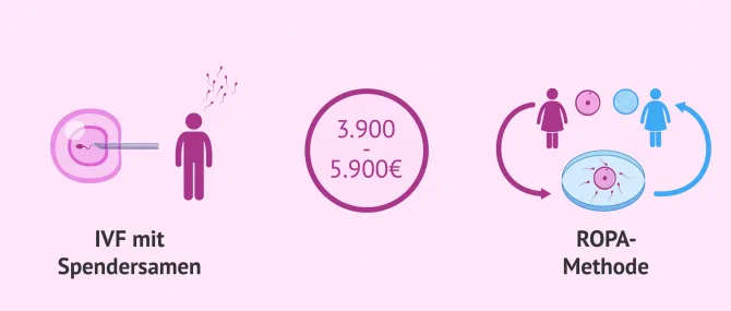 Kosten der Kinderwunschbehandlungen