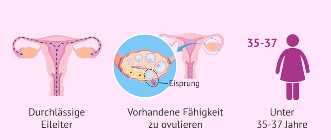 Imagen: Anforderungen für eine Befruchtung
