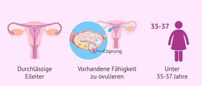 Welche Indikationen gibt es fr eine knstliche Befruchtung?
