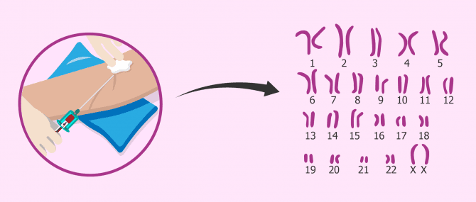 Imagen: Karyotyp um die Sterilität chromosomischen Ursprungs zu untersuchen
