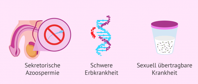 Imagen: Indikation für donogene Insemination