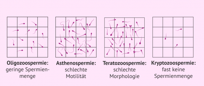 Imagen: IVF bei männlichem Faktor