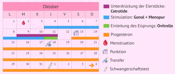 Imagen: Kalender für ein kurzes Stimulationsprotokoll