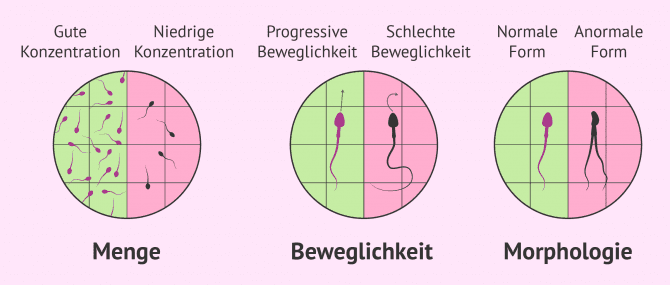 Imagen: Mobilität und Vitalität der Spermien