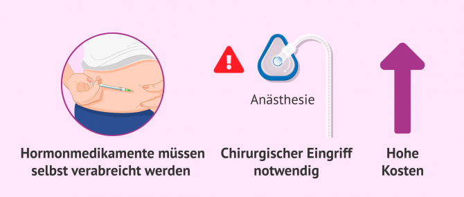 Imagen: Nachteile einer IVF