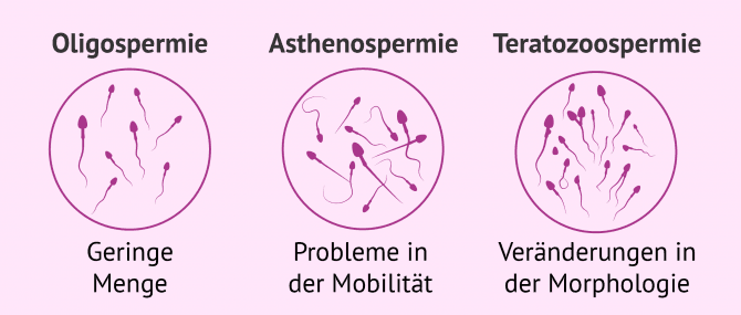 Imagen: Störungen in der Spermienproduktion