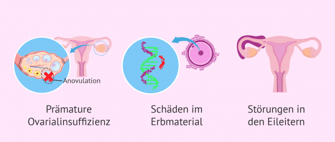 Imagen: Probleme in der Fruchtbarkeit bei Krebspatientinnen