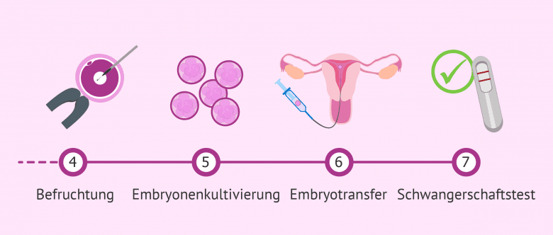Imagen: Vorgehensweise der IVF von der Befruchtung bis zum Embryotransfer