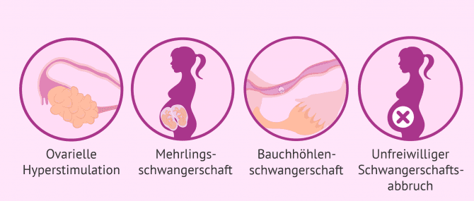 Imagen: Risiken künstliche Befruchtung