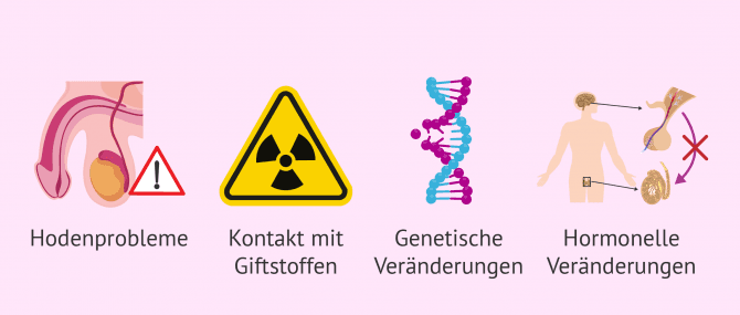 Imagen: Ursachen der sekretorischen Azoospermie