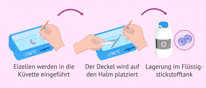 Imagen: Cryotop wird in Flüssigstickstoff getränkt