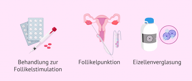 Imagen: Vitrifizierung Eizellen bei Krebsbehandlung