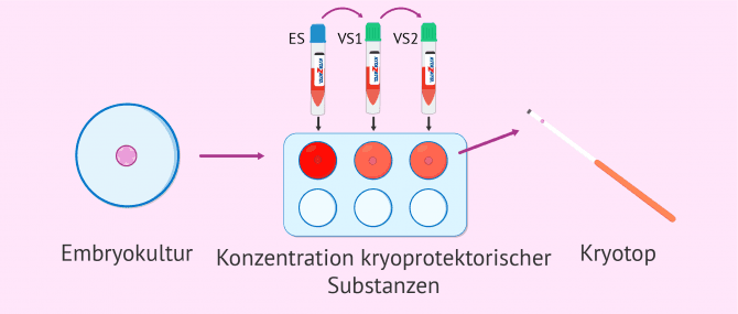 Imagen: Dehidratacion von Embryone zum vitrifizieren