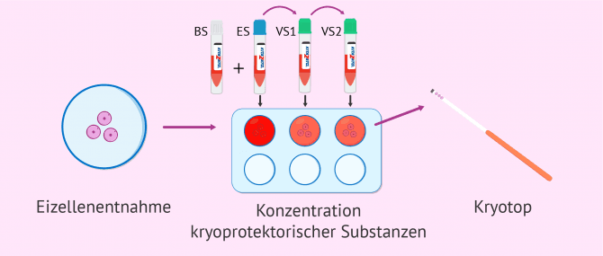 Imagen: Wie das Einfrieren von Eizellen abläuft