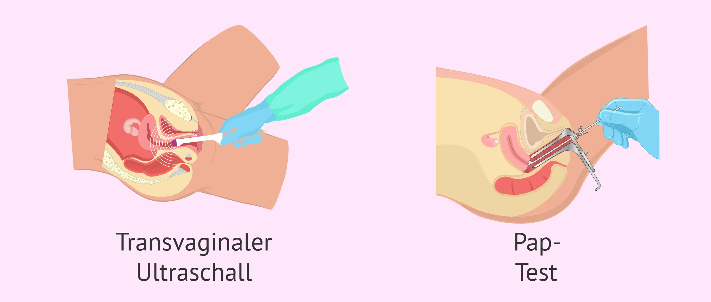 Vanessa Uilyamsning yalangoch fotosurati