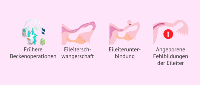 Imagen: Andere Ursachen des Elleiterfaktors