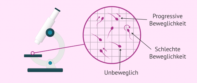 Imagen: Beweglichkeit der Spermien im Mikroskop untersuchen