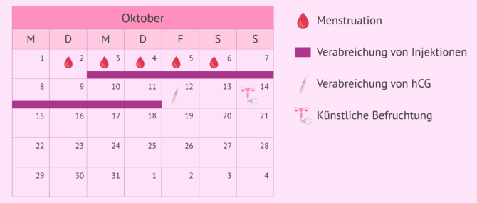 Imagen: KOS-Protokoll bei der künstlichen Befruchtung