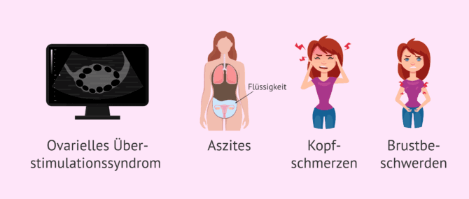 Imagen: Folgen der ovariellen Stimulation bei der künstlichen Befruchtung (AI)