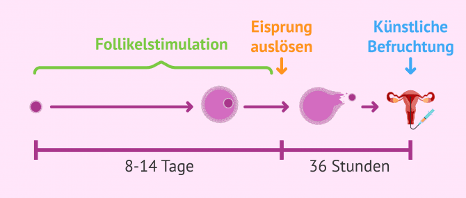 Imagen: Follikelstimulation bei künstlicher Befruchtung